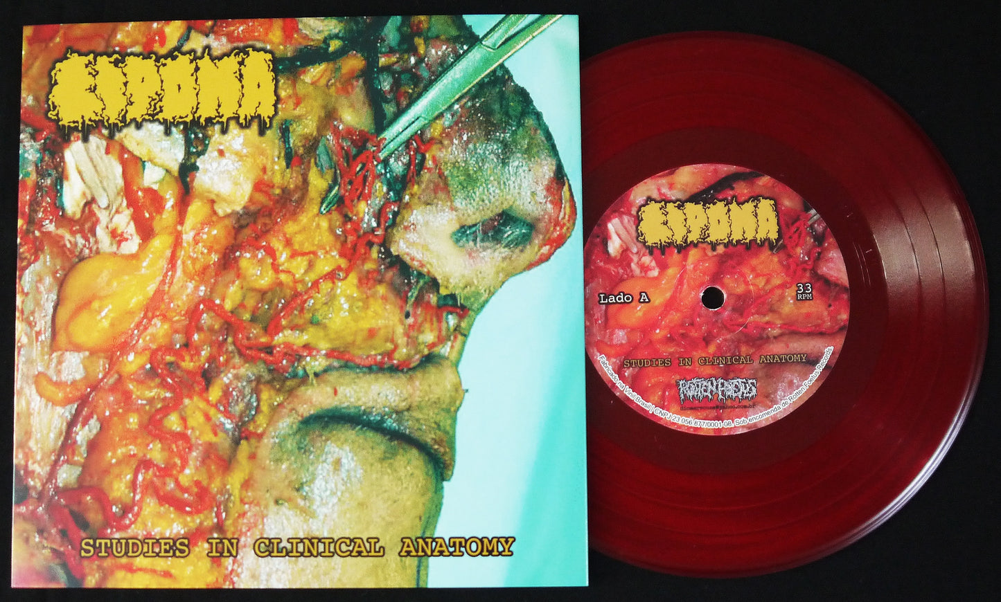 LIPOMA / VOMITO - Split 7"