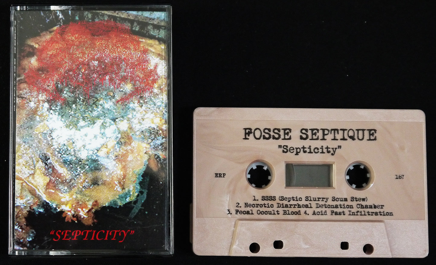 FOSSE SEPTIQUE - Septicity MC Tape