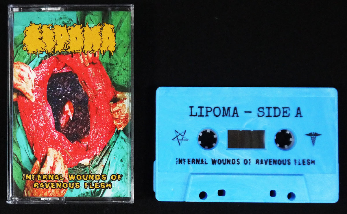 LIPOMA - Infernal Wounds Of Ravenous Flesh MC Tape