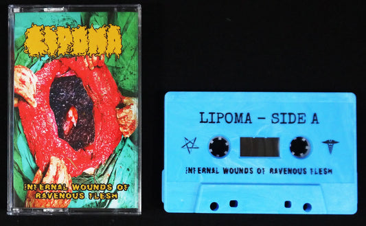 LIPOMA - Infernal Wounds Of Ravenous Flesh MC Tape