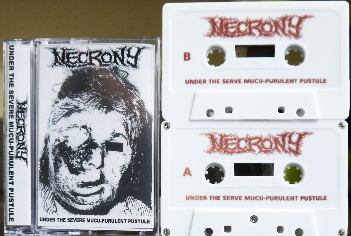 NECRONY - Under The Severe Mucu-Purulent Pustule Tape (120 minutes)
