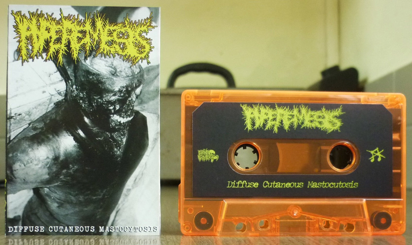HYPEREMESIS / MEATUS - Split Tape