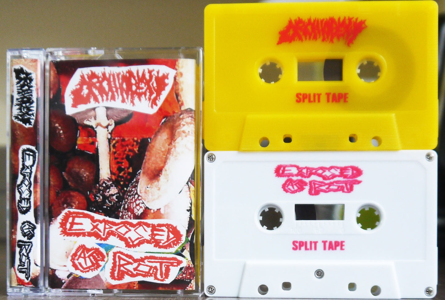 EXPOSED AS ROT / ORCHIOPEXY - Split Tape (Euro Version)