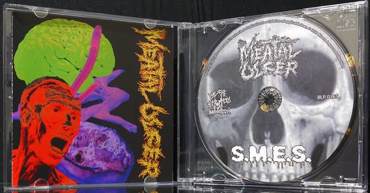 MEATAL ULCER / S.M.E.S. - Split CD
