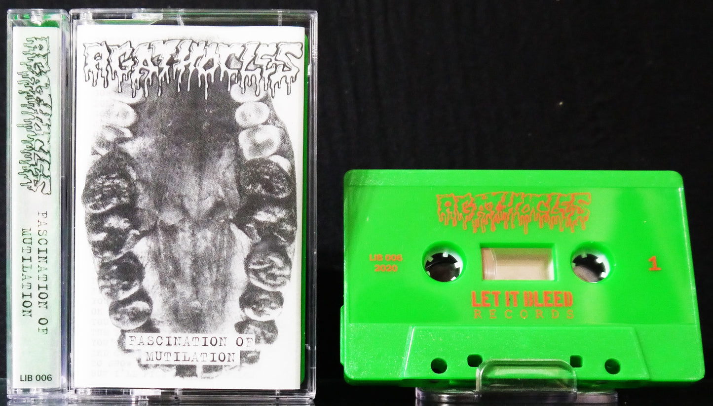 AGATHOCLES - Fascination For Mutilation Tape
