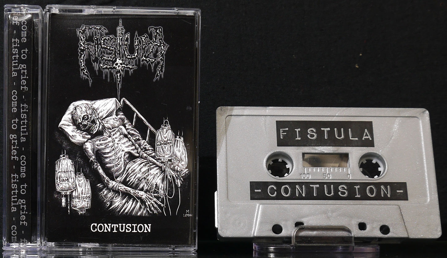 FISTULA / COME TO GRIEF - Split Tape