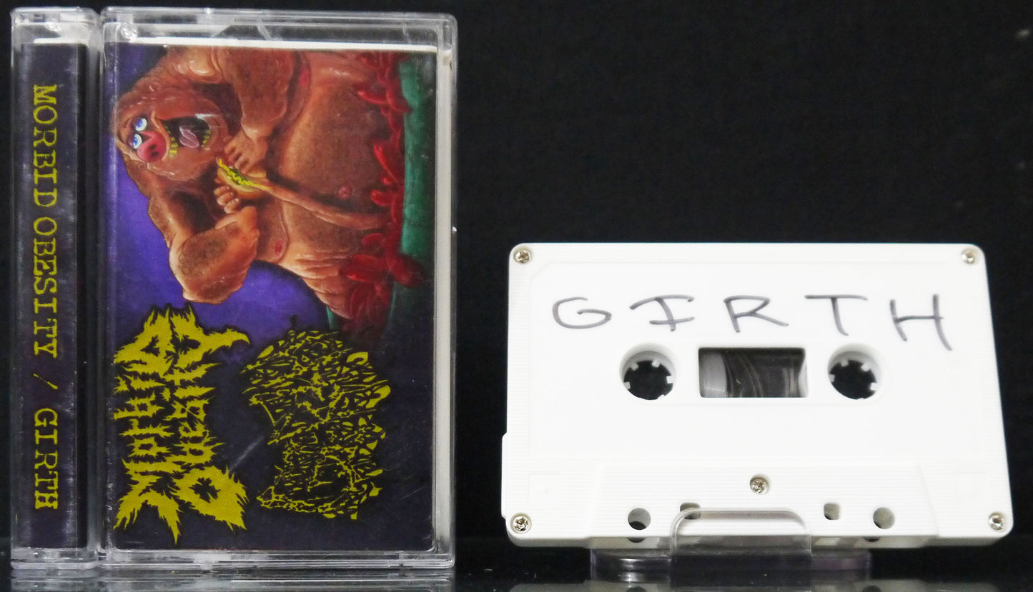 GIRTH / MORBID OBESITY - Split Tape