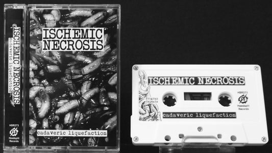 ISCHEMIC NECROSIS - Cadaveric Liquefaction MC Tape