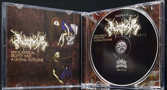 INOPEXIA - Myocardical Biopsy Had A Lethal Outcome CD