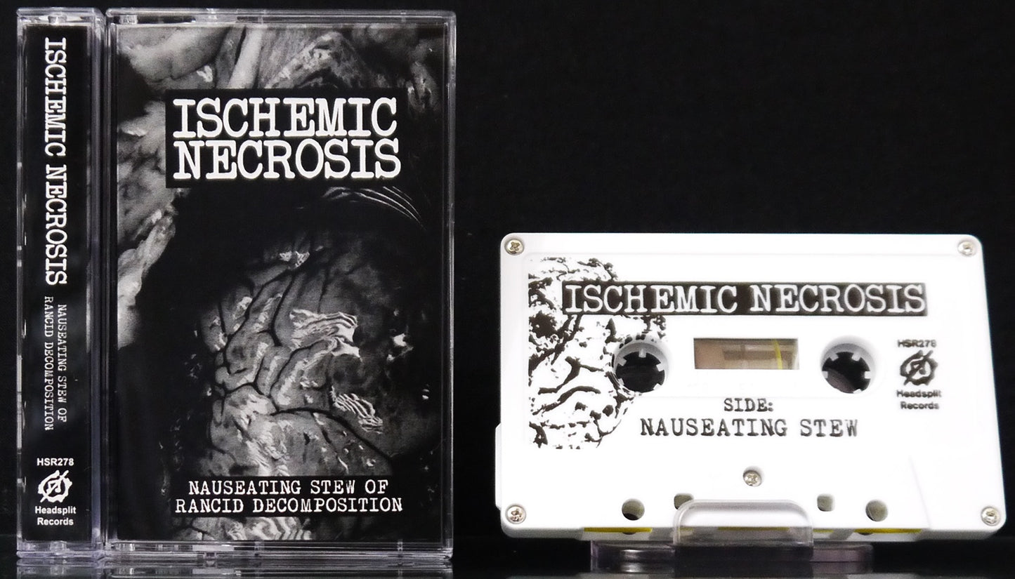 ISCHEMIC NECROSIS - Nauseating Stew Of Rancid Decomposition MC TAPE