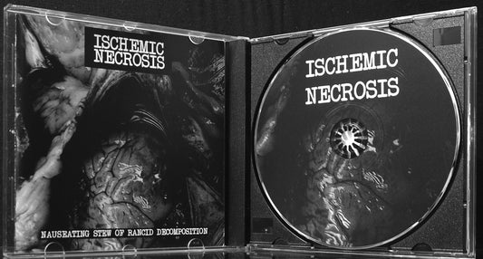 ISCHEMIC NECROSIS - Nauseating Stew Of Rancid Decomposition CD