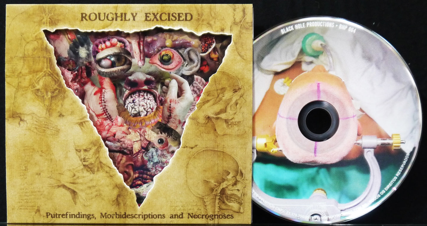 LYMPHATIC PHLEGM - Roughly Excised - Putrefindings, Morbidescriptions And Necrognoses CD