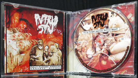 PUTRID STU - Fully Fledged American Gastric Bypass CD