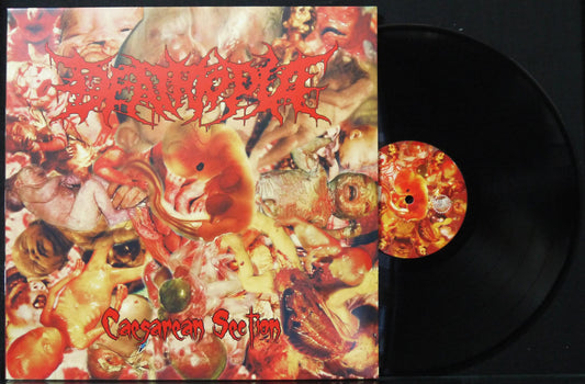 DEATHTOPIA - Caesarean Section 12"