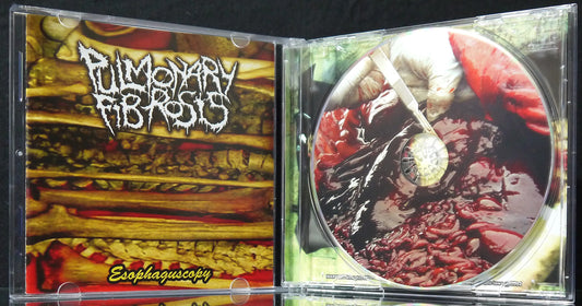 PULMONARY FIBROSIS / OXIDISED RAZOR / BOWEL EVACUATION - 3 Way Split CD