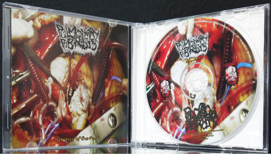 PULMONARY FIBROSIS / PILOCYSTIC ASTROCYTOMA - Split CD