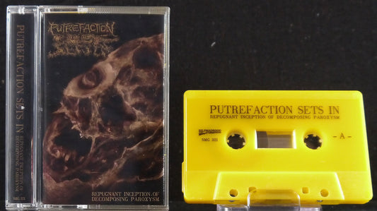 PUTREFACTION SETS IN - Repugnant Inception of Decomposing Paroxysm MC Tape