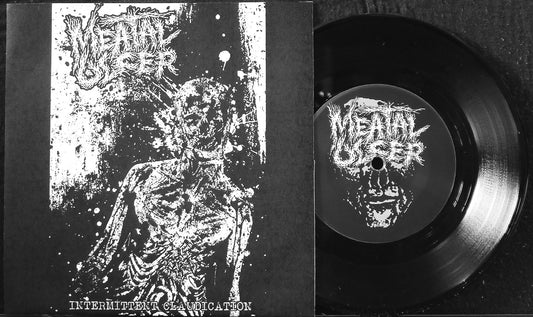 MEATAL ULCER - Intermittent Claudication 7" S/Sided