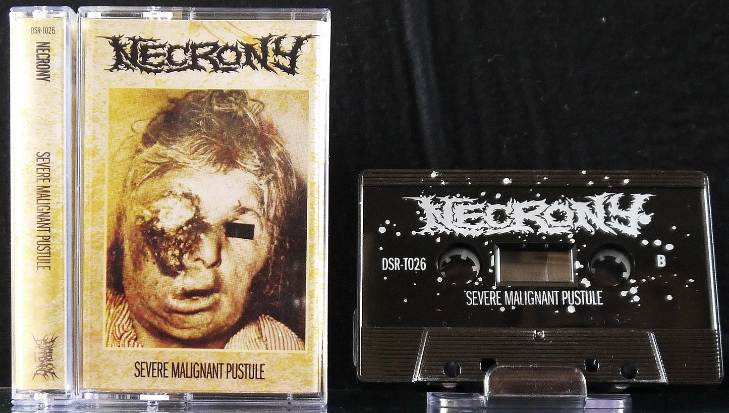 NECRONY - Severe Malignant Pustule MC Tape