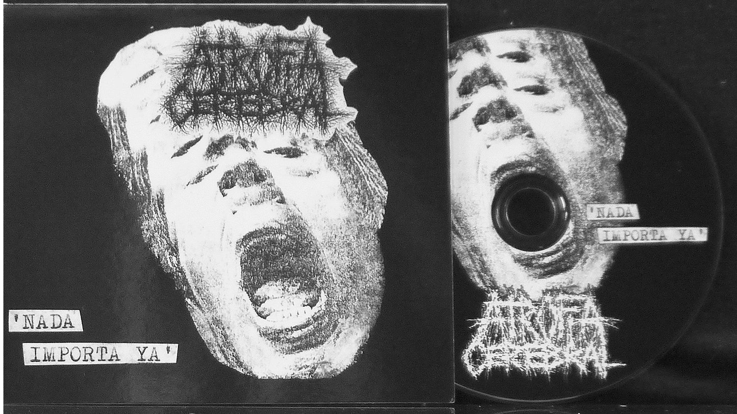 ATROFIA CEREBRAL - Nada Importa Ya Digi ProCDr