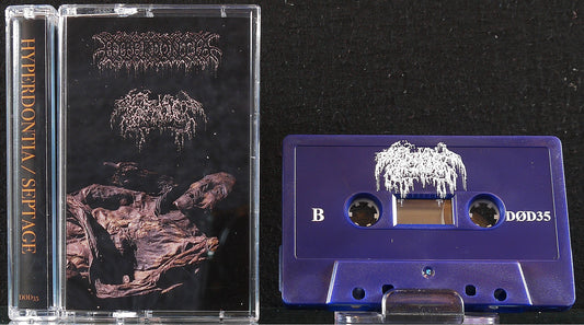 SEPTAGE / HYPERDONTIA - Split Tape