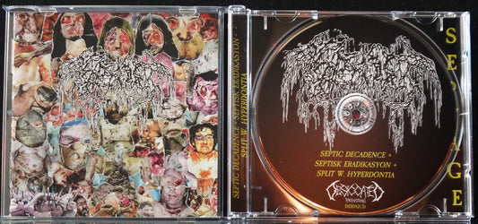 SEPTAGE - Septic Decadence + Septisk Eradikasyon + Split W. Hyperdontia CD