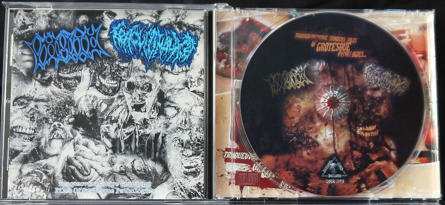 VOMITO / TRAQUEOMALACIA - Split CD